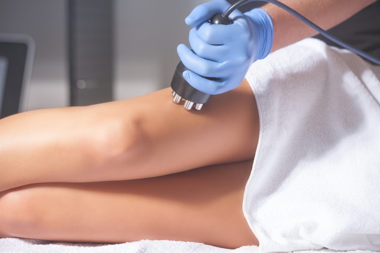 Can You Get Rid of Cellulite? A Look at What is Effective