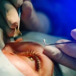 Learning The Causes and Symptoms of Cataract and When to Consult a Cataract Surgeon