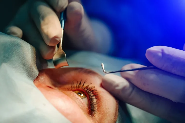 Learning The Causes and Symptoms of Cataract and When to Consult a Cataract Surgeon
